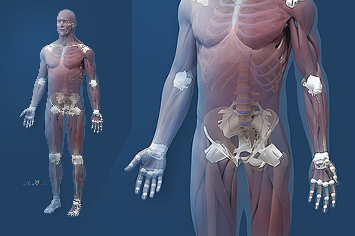 Zygote::(CAD) 3D Male Muscular Skeletal Model | Medically ...